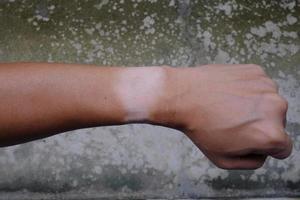 piel de marca de muñeca sin quemaduras solares del reloj de pulsera en la mano izquierda aislada foto