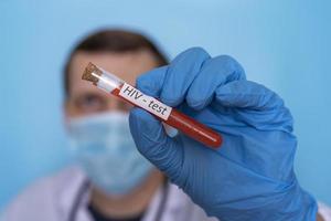 Hiv test, the doctor's hand holds a test tube in medical gloves. photo