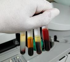 Scientist hand hold Common types of blood serum sample errors. Different types of sample which interfere test result. photo