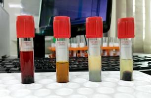 Common types of blood serum sample errors. Different types of sample which interfere test result. photo