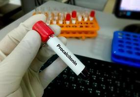 Antibody testing for coronavirus infection. Checking the population for immunity to covid 19. photo