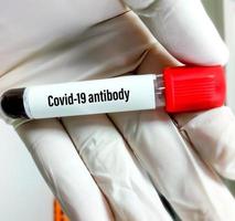 Hand of scientist hold a test tube which is ready for Covid-19 antibody test in laboratory. Biochemistry lab. Corona virus. Pandemic disease.  close view. IgG, IgM test of Covid-19. virus infection. photo