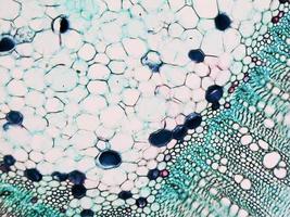 Cotton stem micrograph photo