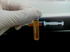 Biochemist hold Cerebrospinal fluid or CSF sample, which is ready for biochemical test including Glucose, Protein, ADA. Closeup photo