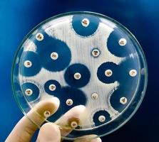 mano sosteniendo una placa de cultivo de crecimiento bacteriano que muestra sensibilidad a los antibióticos en su colonia foto
