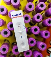 Rapid screening test for Covid-19 variant. Gamma variant photo