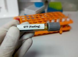 Technician or scientist hold a sample tube of Glucose Tolerance Test fasting or GTT photo
