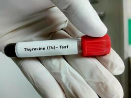 Blood sample for Thyroxine or T4 hormone test. Thyroid hormone. photo