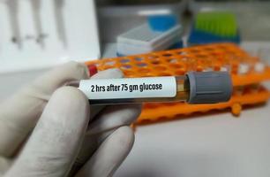 tubo de muestra de sangre para la prueba de glucosa en plasma 2 horas después de tomar 75 gramos de glucosa. diagnóstico de hiperglucemia o hipoglucemia. prueba de tolerancia a la glucosa. foto