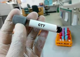 Technician or scientist hold a sample tube of Glucose Tolerance Test or GTT photo