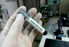 técnico o científico sostiene un tubo de muestra de azúcar en sangre al azar o prueba de rbs. concepto de prueba médica foto
