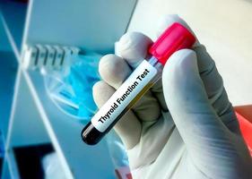 Thyroid function tests, Diagnosis of hyperthyroidism or hypothyroidism of a patient photo