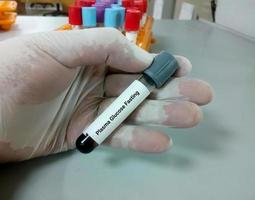 scientist hold a sample tube of Plasma glucose Fasting photo