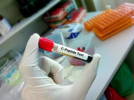 Blood sample tube for C peptide test, diagnosis of diabetes disease photo