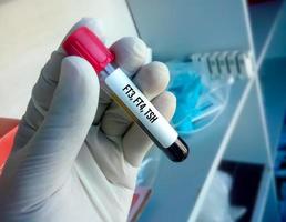 Blood sample in test tube for hormonal examination of thyroid gland in laboratory. FT3, FT4, TSH. Diagnosis of hyperthyroidism or hypothyroidism of a patient photo