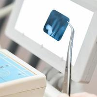 el dentista tiene una radiografía de varios dientes, diagnóstico y evaluación de los dientes con una radiografía. foto