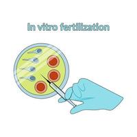 In vitro fertilization. Detailed infographic showing laboratory fertilization of eggs. Vector flat style