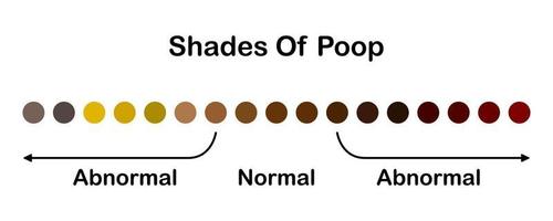 Human feces color. Shades color of poop. Normal and abnormal value scale. Healthy concept. Vector