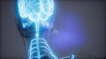Röntgenuntersuchung des menschlichen Gehirns video