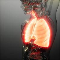 Human Lungs Radiology Exam photo