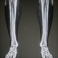 Transparent Human Body with Visible Bones photo