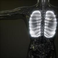 Human Lungs Radiology Exam photo