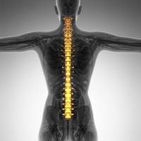 Human backache and back pain with an upper torso body skeleton showing the spine and vertebral column photo