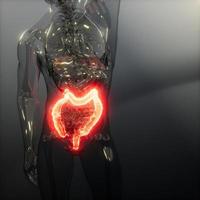 examen de radiología de colon humano