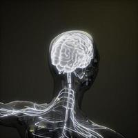 examen de radiología del cerebro humano foto