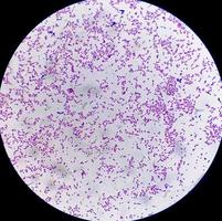 Escherichia coli bacterium, E.coli, gram-negative rod-shaped bacteria, part of intestinal normal flora and causative agent of diarrhea and inflammations of different location. Close up micrograph photo