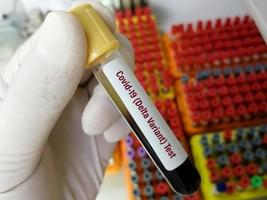 técnico que sostiene un tubo de análisis de sangre identificado con la etiqueta covid-19 variante delta. médico con una muestra de sangre positiva para la nueva variante detectada de la cepa de coronavirus llamada delta foto