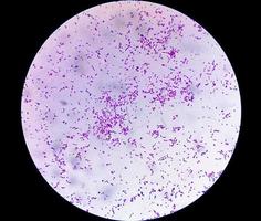 bacteria escherichia coli, e.coli, bacteria gramnegativa en forma de bastoncillo, parte de la flora intestinal normal y agente causante de diarreas e inflamaciones de diferente localización. cerrar micrografía foto