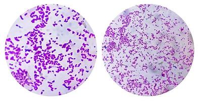 photo collage of Escherichia coli bacterium, E.coli, gram-negative rod-shaped bacteria, part of intestinal normal flora and causative agent of diarrhea and inflammations of different location.
