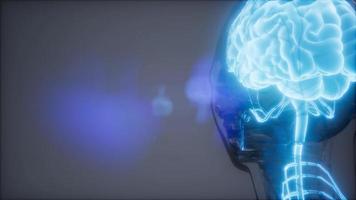 esame di radiologia cerebrale umana