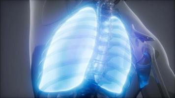 examen radiologique des poumons humains video