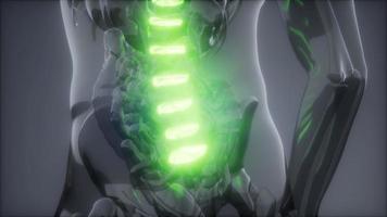 Rückenschmerzen in den Rückenknochen video