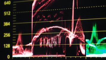 Color grading graph or RGB colour correction indicator on monitor photo