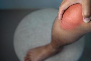 el hombre sostiene su punto de dolor en la articulación de la rodilla. el punto rojo muestra la posición de la lesión. foto