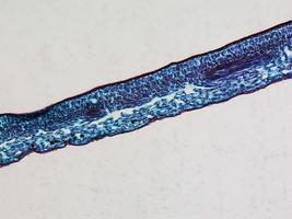 micrografía de la sección de la hoja foto