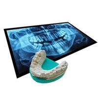 Xray of teeth with positive teeth cast photo