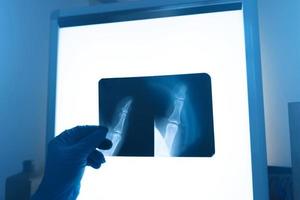 los trabajadores médicos en el hospital examinan las impresiones de rayos X. foto