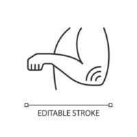 Elbow rheumatism linear icon. Soft tissue disorder. Rheumatoid arthritis. Throbbing pain in joint. Thin line customizable illustration. Contour symbol. Vector isolated outline drawing. Editable stroke