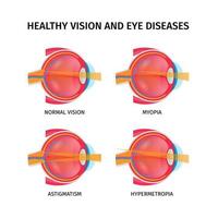 conjunto de anatomía del ojo humano vector