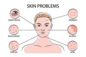 Skin Problems Infographics vector