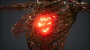 CG Animation Of A Sick Human Heart photo