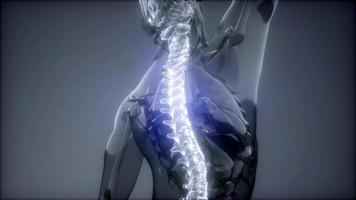 Backache in Back Bones photo