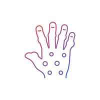 Psoriatic arthritis gradient linear vector icon. Painful hand joints. Permanent bones damage. Fingers deformity. Thin line color symbol. Modern style pictogram. Vector isolated outline drawing