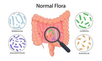 anatomía intestinal, infografía de microflora intestinal. vector