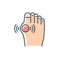 Gout RGB color icon. Inflammatory arthritis type. Uric acid buildup. Affecting joint in big toe. Hyperuricemia condition. Intense joint pain. Isolated vector illustration. Simple filled line drawing