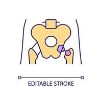 Hip replacement RGB color icon. Artificial prothesis. Metal joint implant. Surgical treatment. Body part. Damage consequence. Isolated vector illustration. Simple filled line drawing. Editable stroke